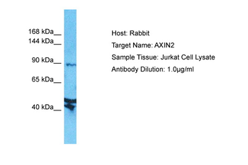 AXIN2 Rabbit Polyclonal Antibody