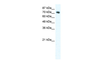 DVL1 Rabbit Polyclonal Antibody
