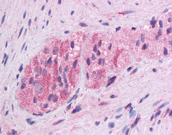 WNT5A Rabbit Polyclonal Antibody