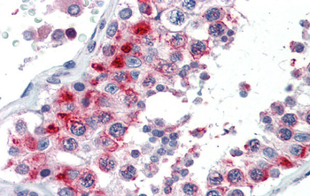 GSC Rabbit Polyclonal Antibody