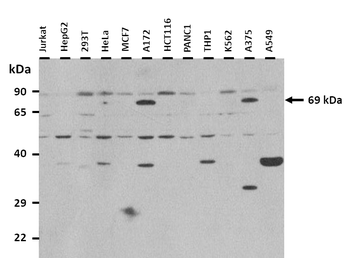 ZNF746 Rabbit Polyclonal Antibody