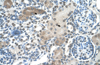 DLX2 Rabbit Polyclonal Antibody