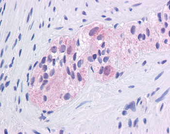EGR1 Rabbit Polyclonal Antibody