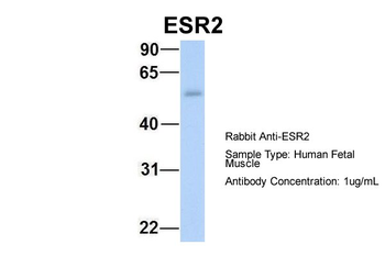 ESR2 Rabbit Polyclonal Antibody