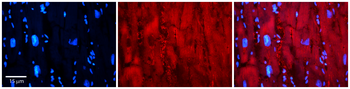 EWSR1 Rabbit Polyclonal Antibody