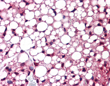 Atf6 Rabbit Polyclonal Antibody