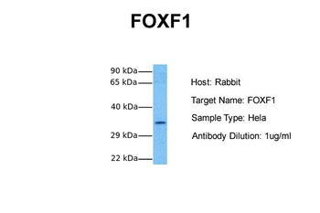 FOXF1 Rabbit Polyclonal Antibody