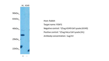 FOXF1 Rabbit Polyclonal Antibody