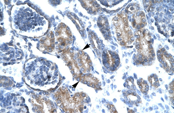 FOXF1 Rabbit Polyclonal Antibody