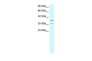 FOXL1 Rabbit Polyclonal Antibody