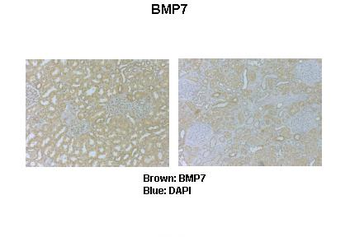 Bmp7 Rabbit Polyclonal Antibody