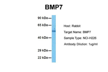 BMP7 Rabbit Polyclonal Antibody