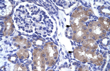 ASCL1 Rabbit Polyclonal Antibody