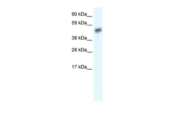 SIRT2 Rabbit Polyclonal Antibody