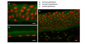 ZEB1 Rabbit Polyclonal Antibody
