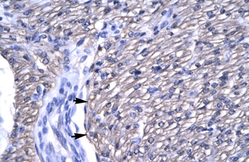 OTX2 Rabbit Polyclonal Antibody