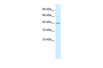 PAX3 Rabbit Polyclonal Antibody