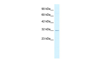 PSMD14 Rabbit Polyclonal Antibody