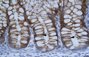 SUV39H1 Rabbit Polyclonal Antibody