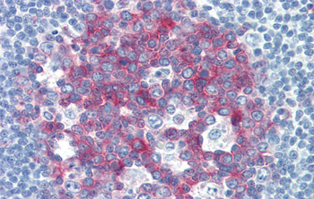 NCOA3 Rabbit Polyclonal Antibody