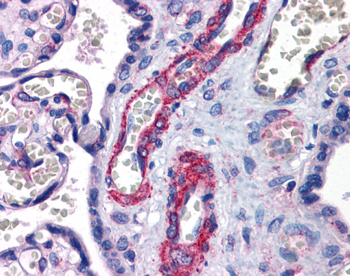 SUZ12 Rabbit Polyclonal Antibody