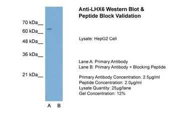 LHX6 Rabbit Polyclonal Antibody