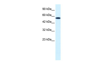 CHEK1 Rabbit Polyclonal Antibody