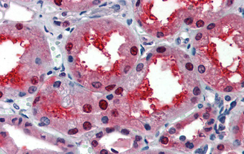 LASS2 Rabbit Polyclonal Antibody