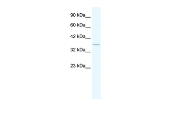 HCLS1 Rabbit Polyclonal Antibody
