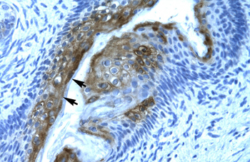 HDAC2 Rabbit Polyclonal Antibody