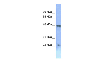 HOXA2 Rabbit Polyclonal Antibody