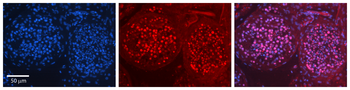 ILF3 Rabbit Polyclonal Antibody