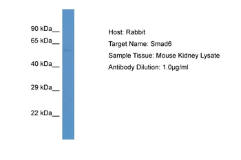 Smad6 Rabbit Polyclonal Antibody