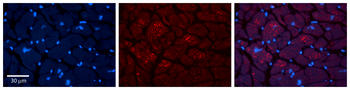 MBD1 Rabbit Polyclonal Antibody