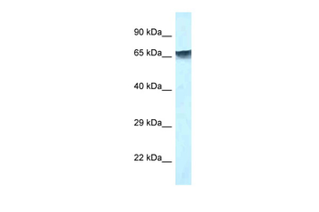 MBD1 Rabbit Polyclonal Antibody