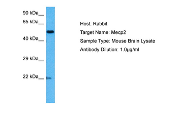 MECP2 Rabbit Polyclonal Antibody
