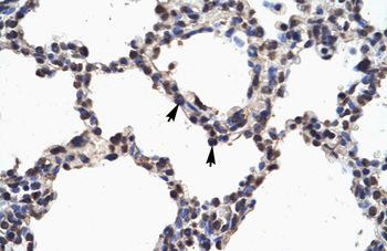 NFKB2 Rabbit Polyclonal Antibody