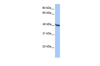 OLIG2 Rabbit Polyclonal Antibody