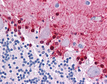 KLF2 Rabbit Polyclonal Antibody