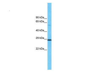 PHB Rabbit Polyclonal Antibody