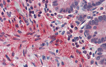 PRDM5 Rabbit Polyclonal Antibody