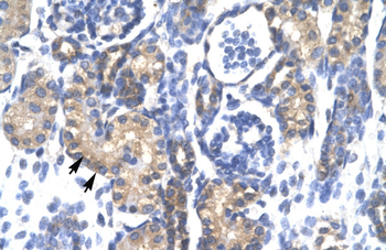 PSMC3 Rabbit Polyclonal Antibody