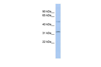 SUFU Rabbit Polyclonal Antibody