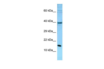Pole3 Rabbit Polyclonal Antibody