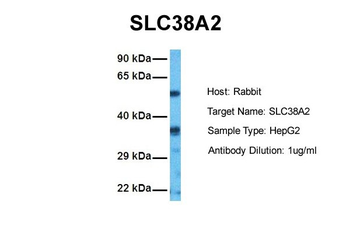 SLC38A2 Rabbit Polyclonal Antibody