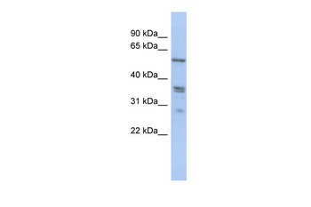 SLC38A2 Rabbit Polyclonal Antibody