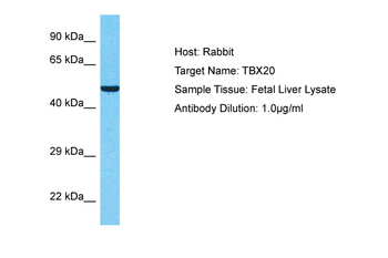 TBX20 Rabbit Polyclonal Antibody