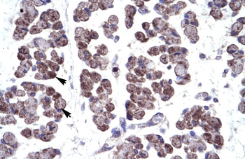 TBX20 Rabbit Polyclonal Antibody