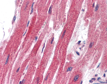 SNAI2 Rabbit Polyclonal Antibody