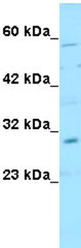 SNAI1 Rabbit Polyclonal Antibody